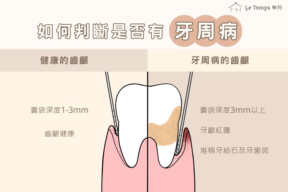 如何判斷是否有牙周病