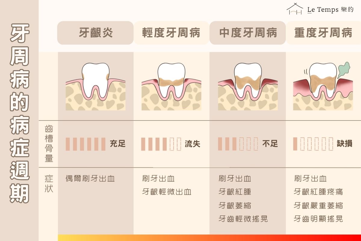 牙周病的週期