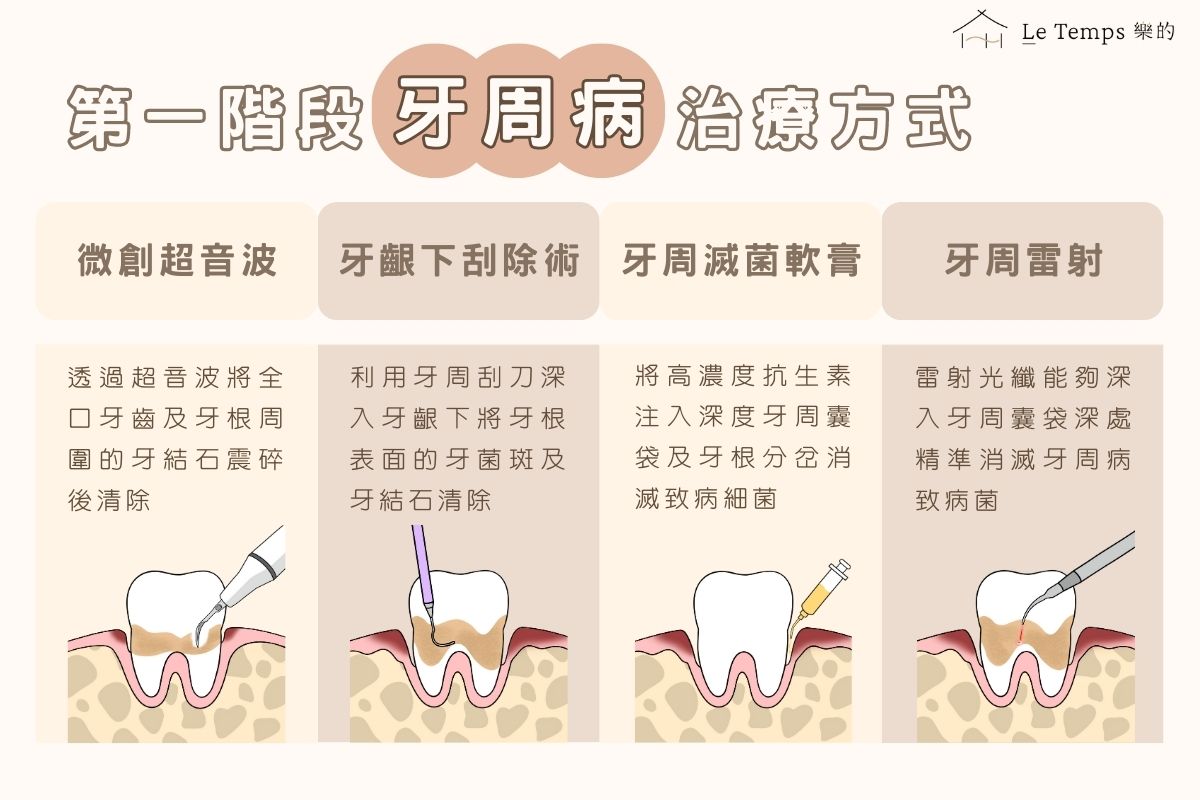 牙周病的治療方式