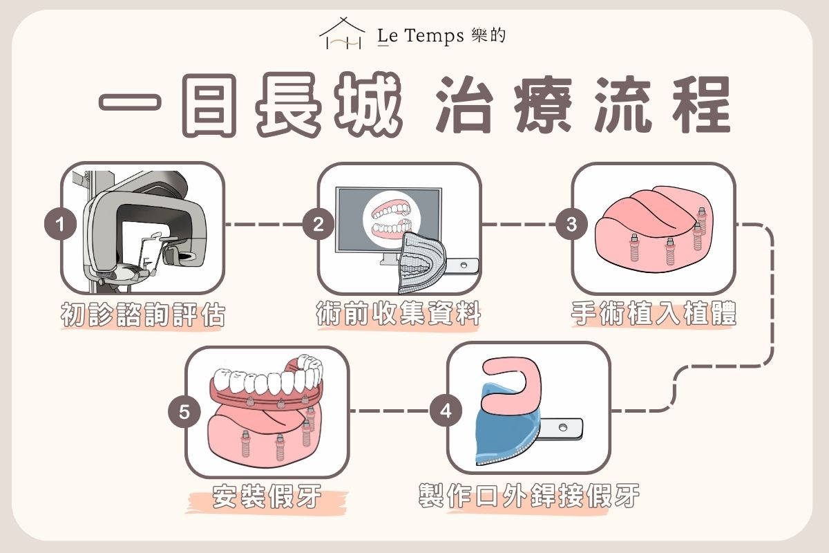 一日長城全口重建流程