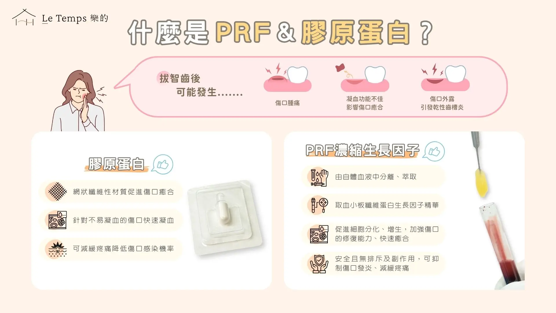 智齒prf膠原蛋白ppt