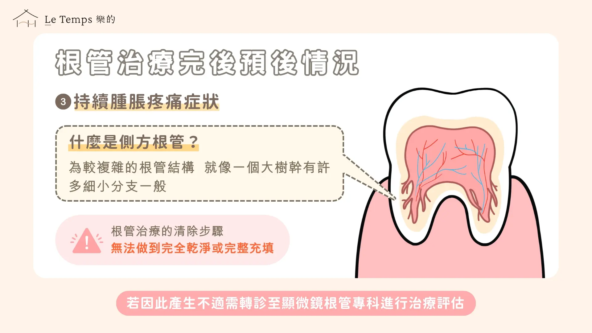 一般根管治療 4