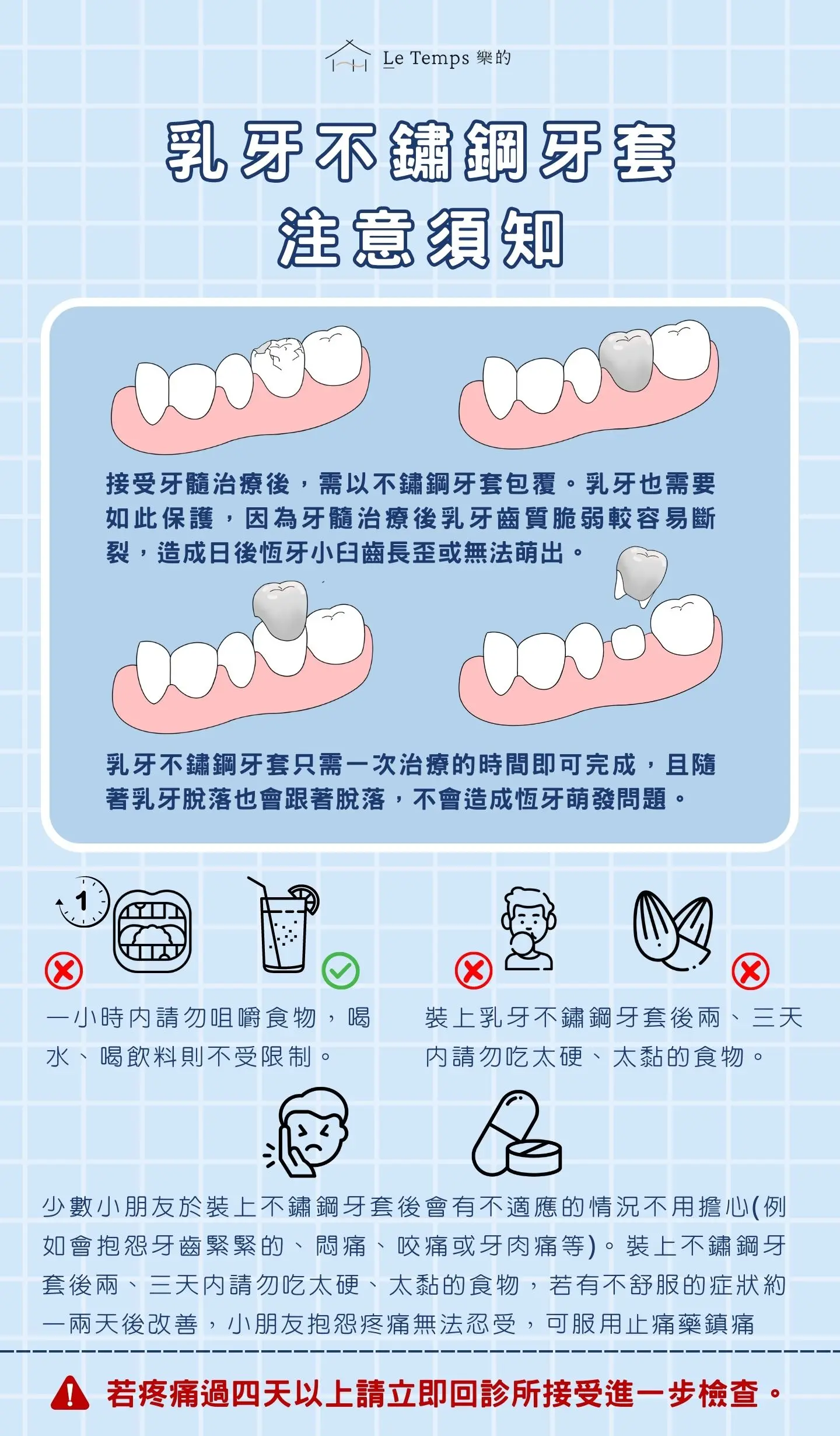 乳牙不鏽鋼牙套 注意須知