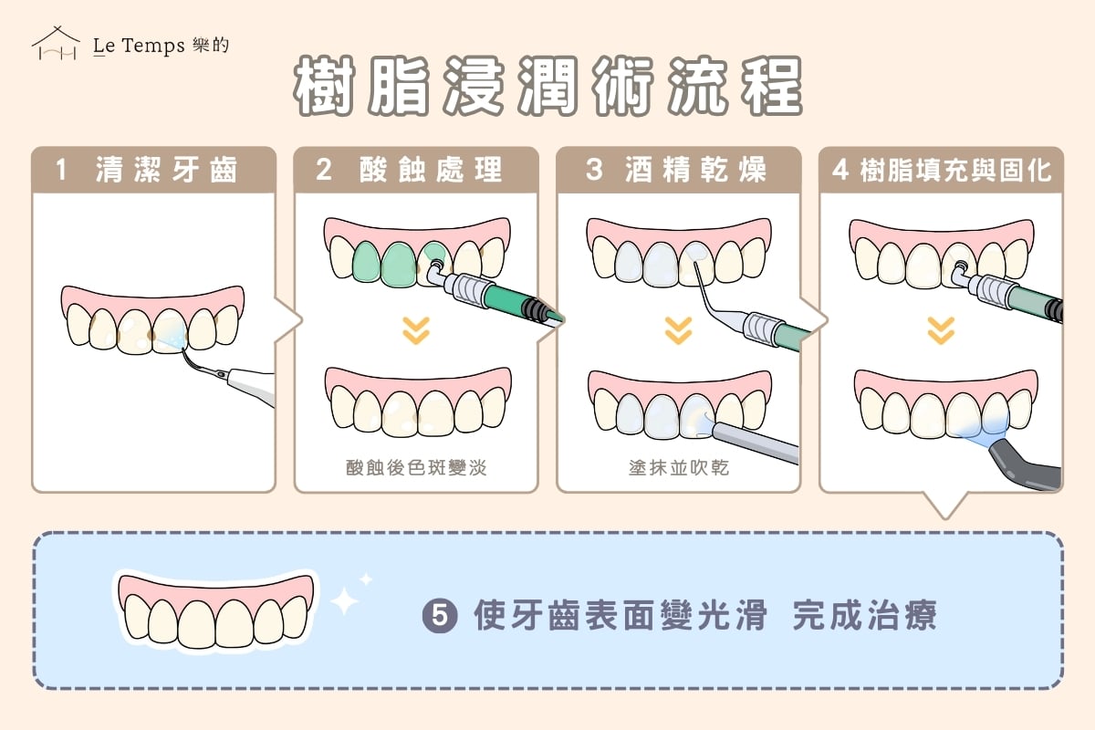 樹脂浸潤術的流程