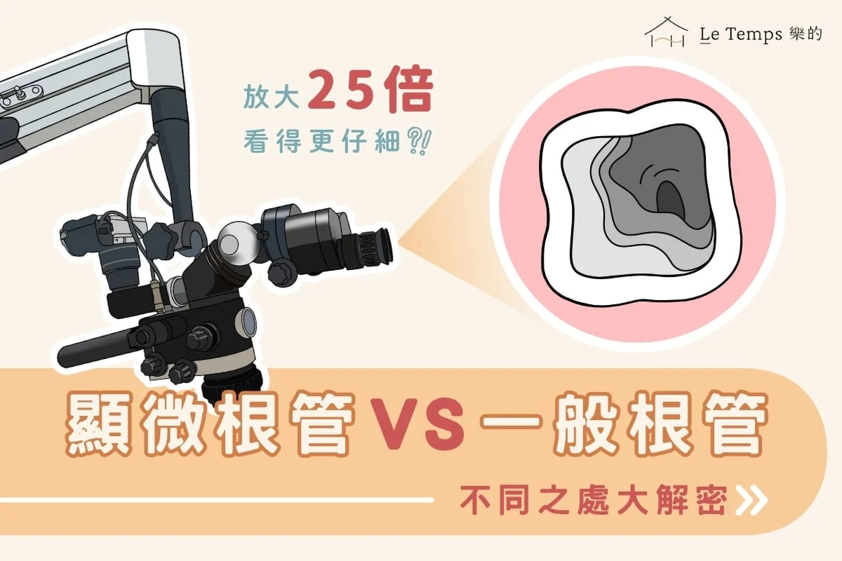顯微根管治療與一般根管治療的差別