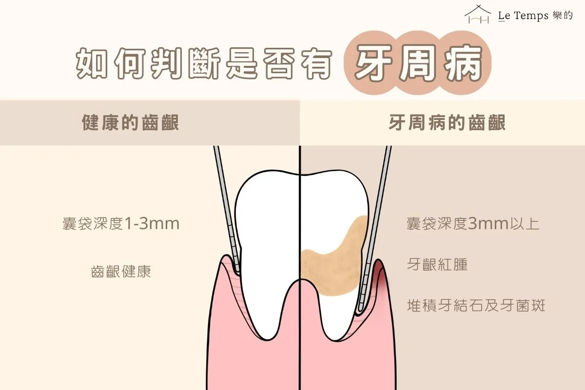 如何判斷牙周病