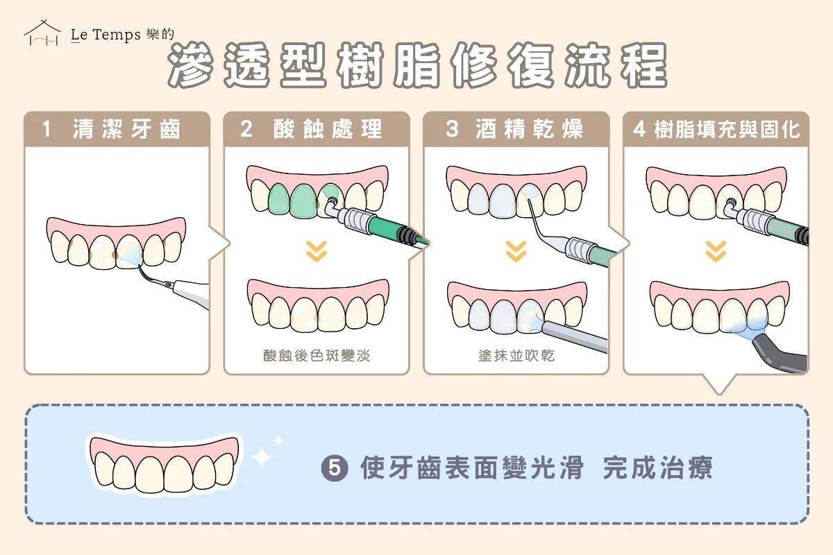 滲透型樹脂修復的流程