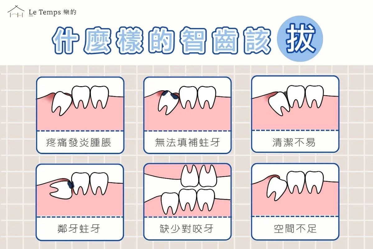 什麼樣的智齒該拔？ 