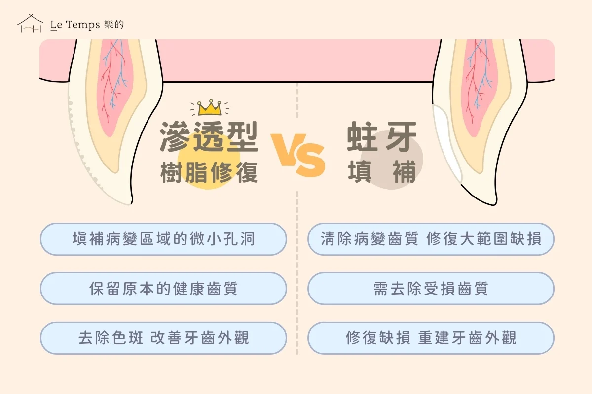 滲透型樹脂修復與一般補蛀牙的方式有什麼不同呢？