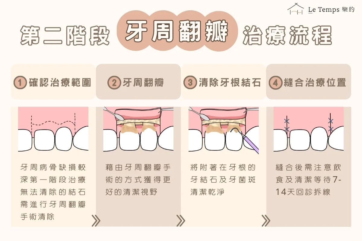 第二階段牙周翻瓣治療流程