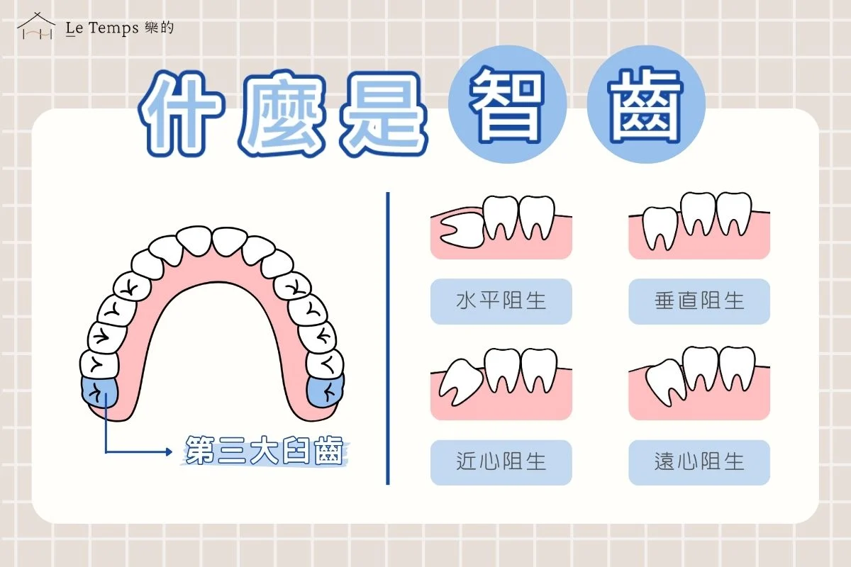什麼是智齒？