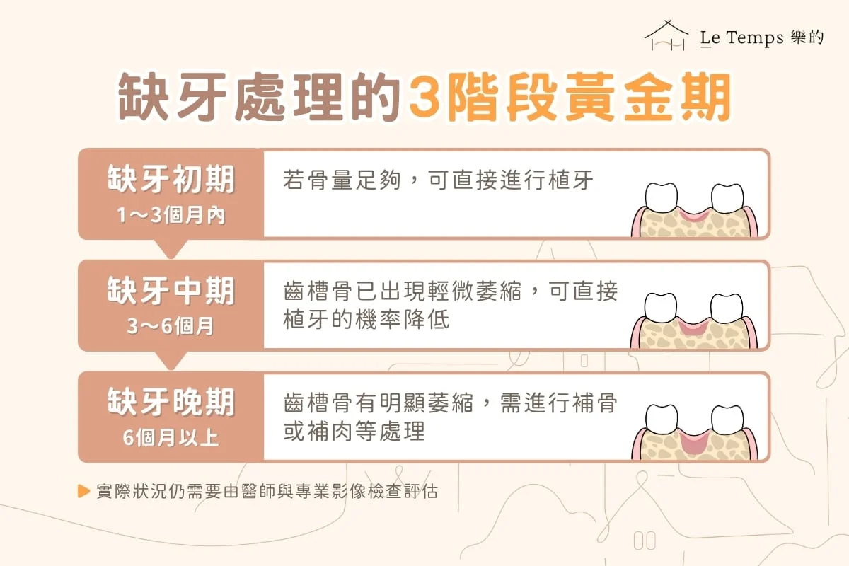 缺牙處理三大黃金期