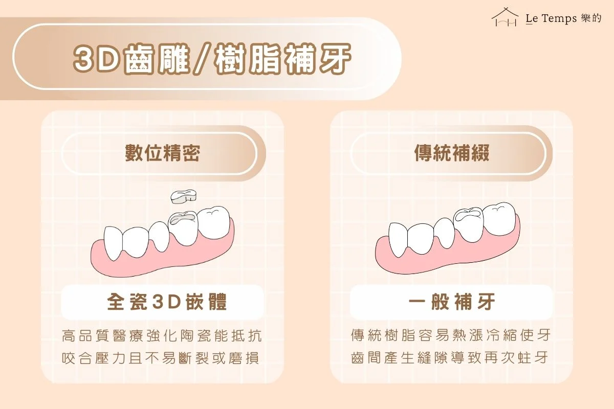 3d齒雕樹脂補牙