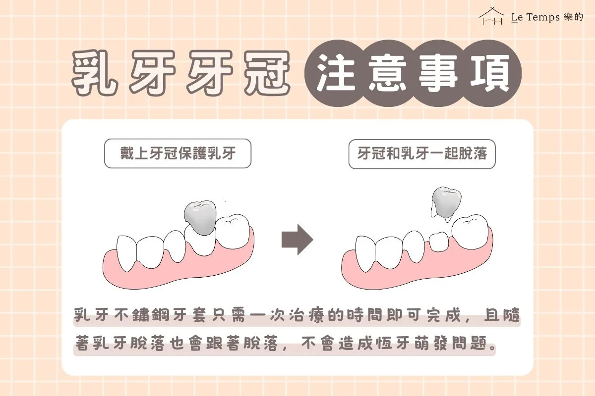 乳牙牙冠注意事項