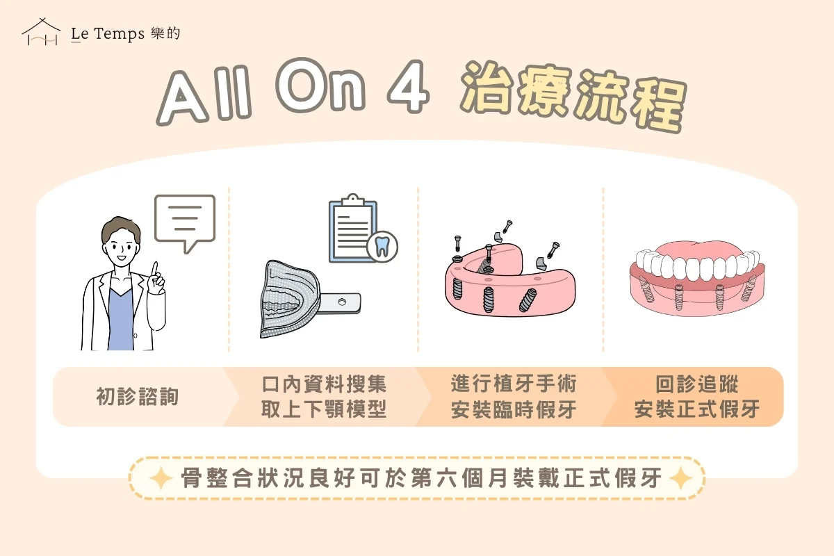 全口重建all On 4 治療流程