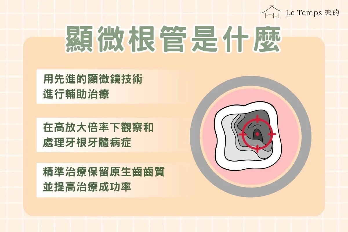顯微根管是什麼？