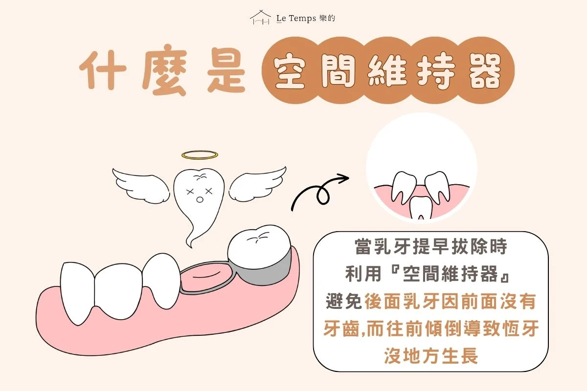 什麼是空間維持器