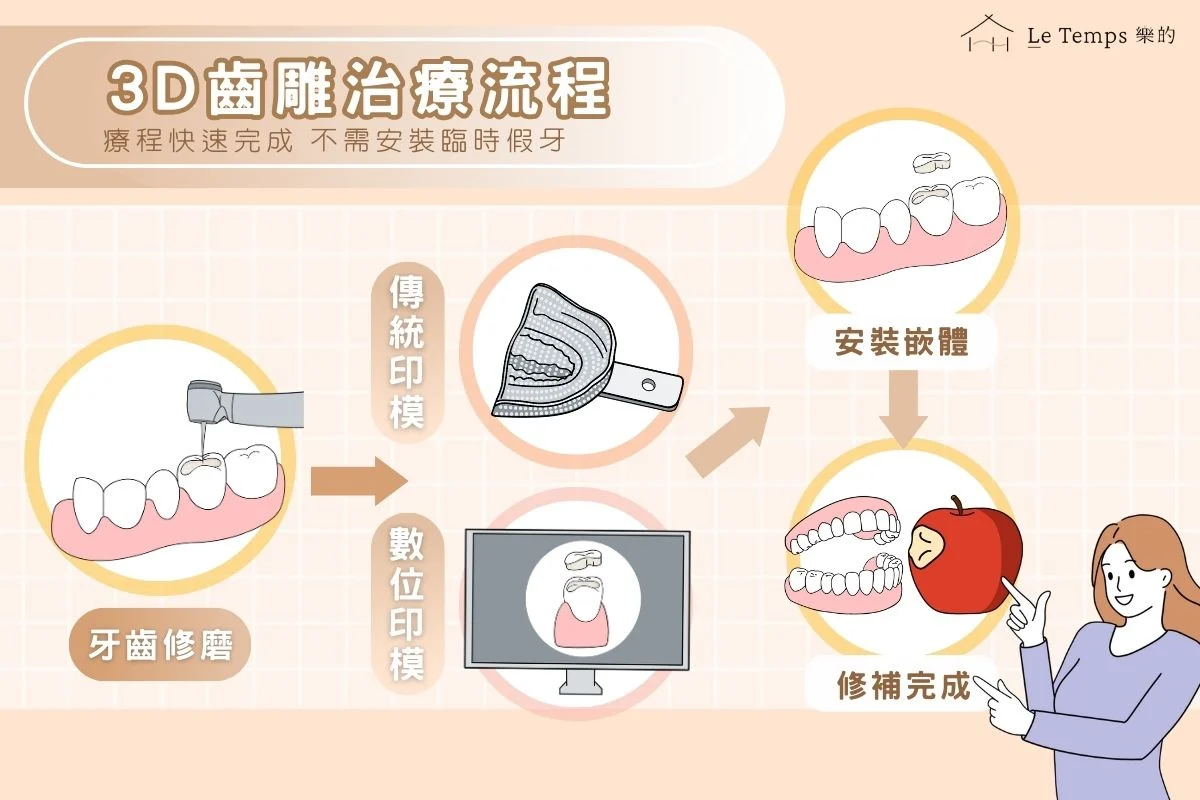 3d齒雕治療流程