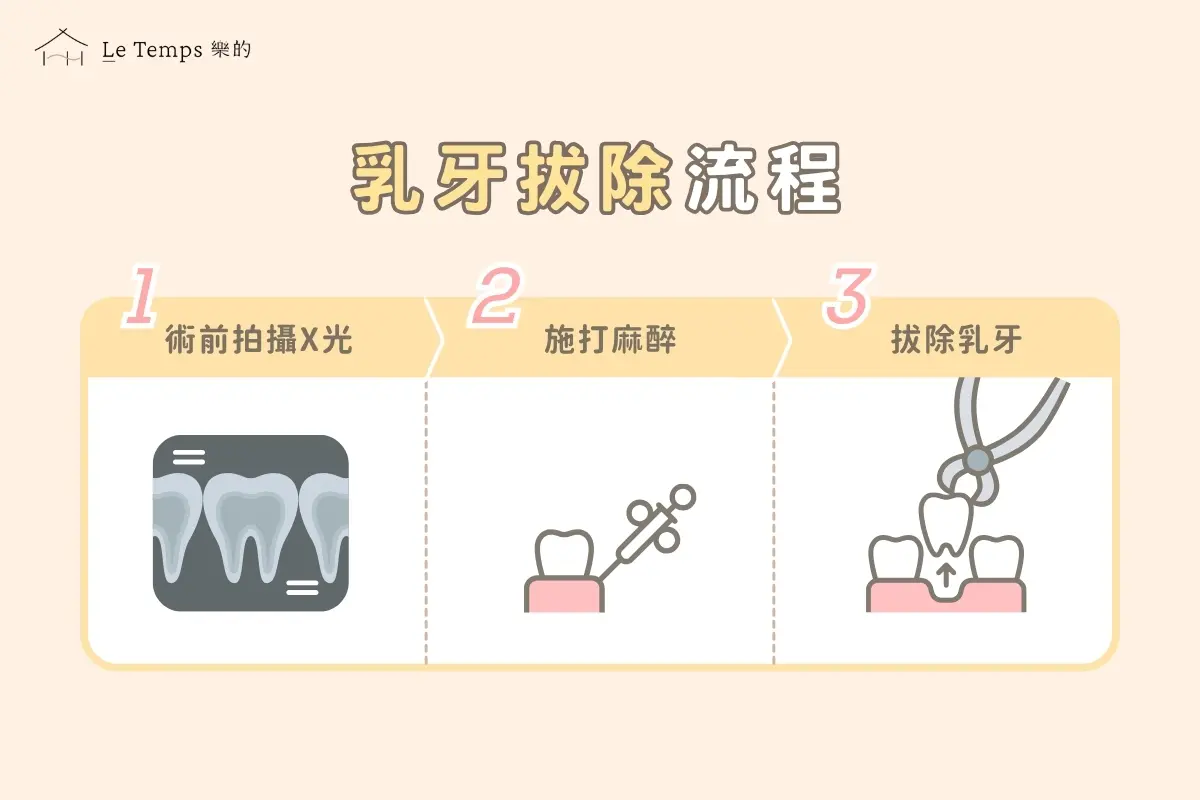 乳牙拔除3
