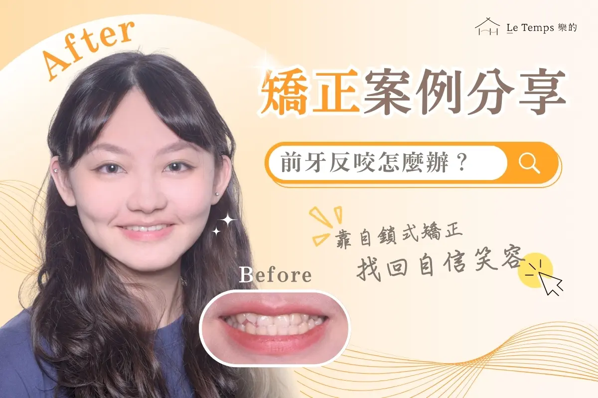 0811自鎖式矯正1