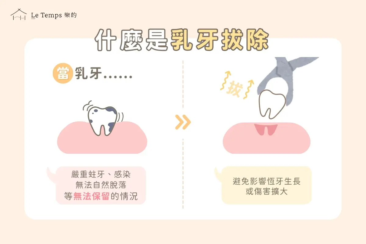 乳牙拔除1