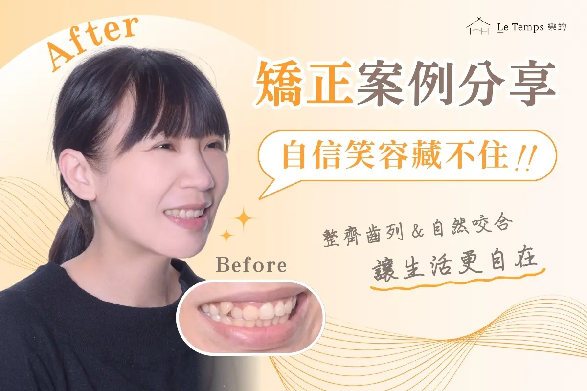 0804自鎖式矯正案例分享1