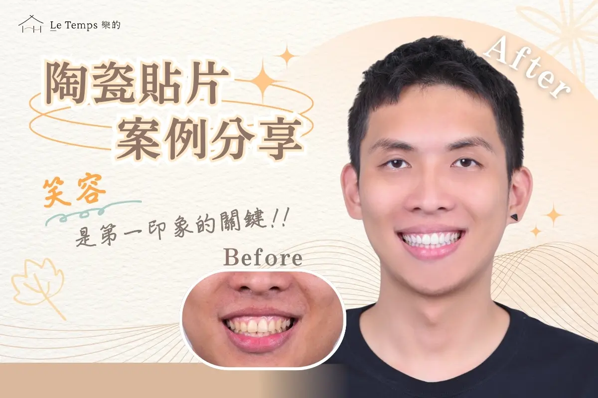 1014陶瓷貼片案例分享1