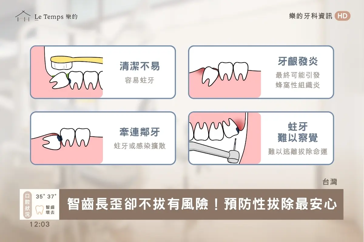 阻生智齒一定要拔嗎4