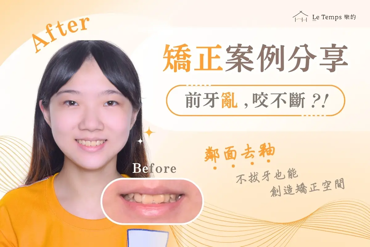 1104自鎖式矯正案例分享1