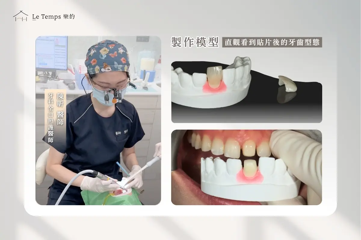 1215陶瓷貼片案例分享2