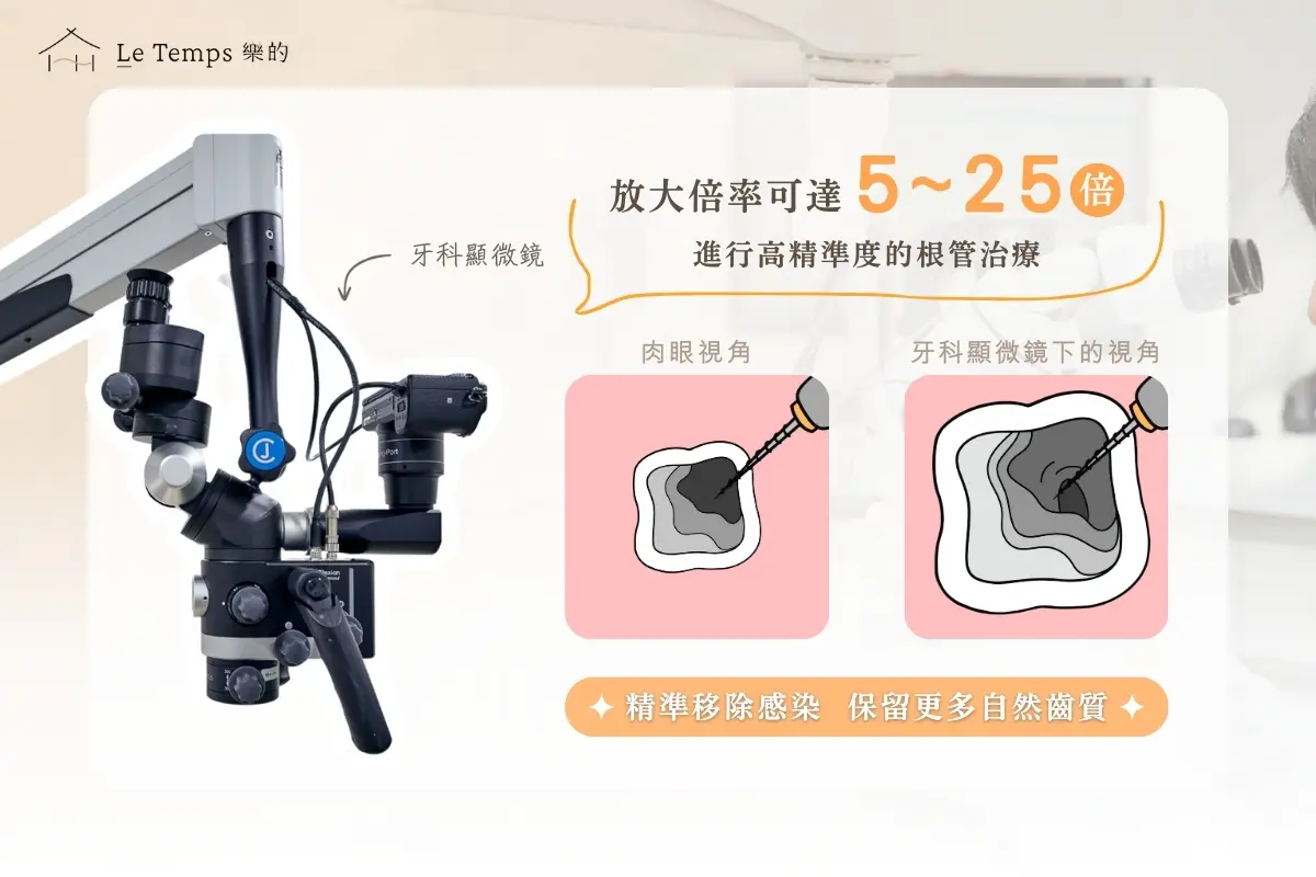 為什麼要選擇顯微根管?2