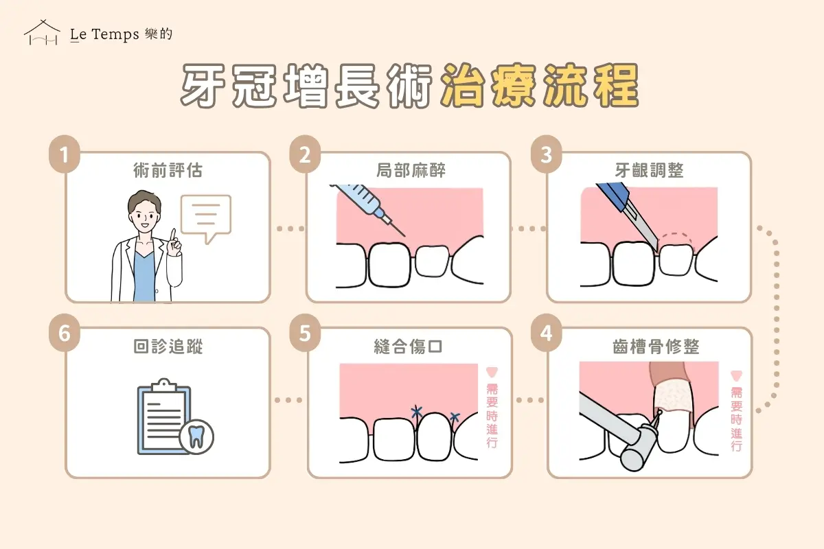 治療項目 牙冠增長術3