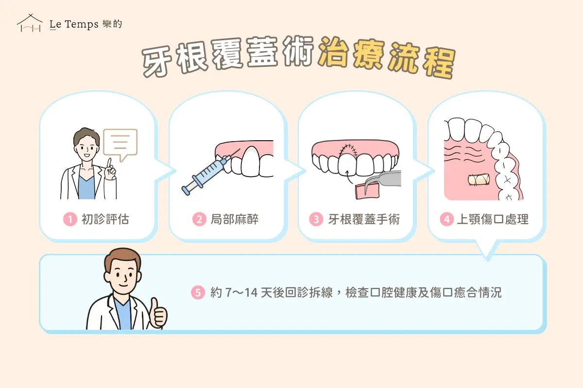 治療項目 牙根覆蓋術3