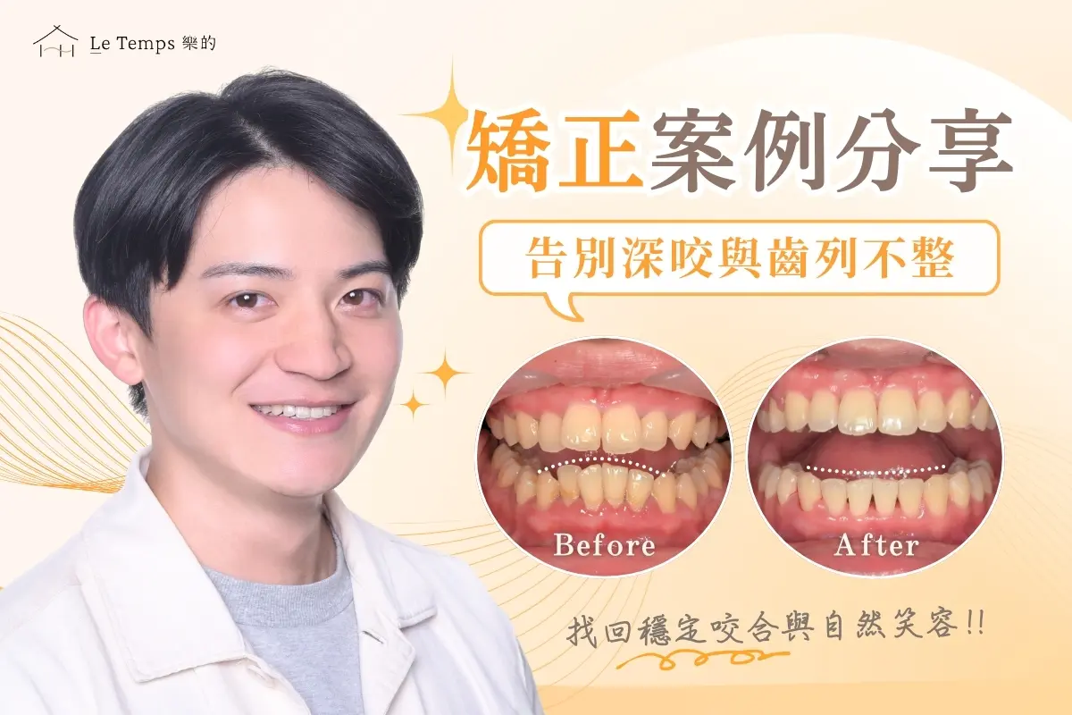 黃健翔 自鎖式矯正案例1