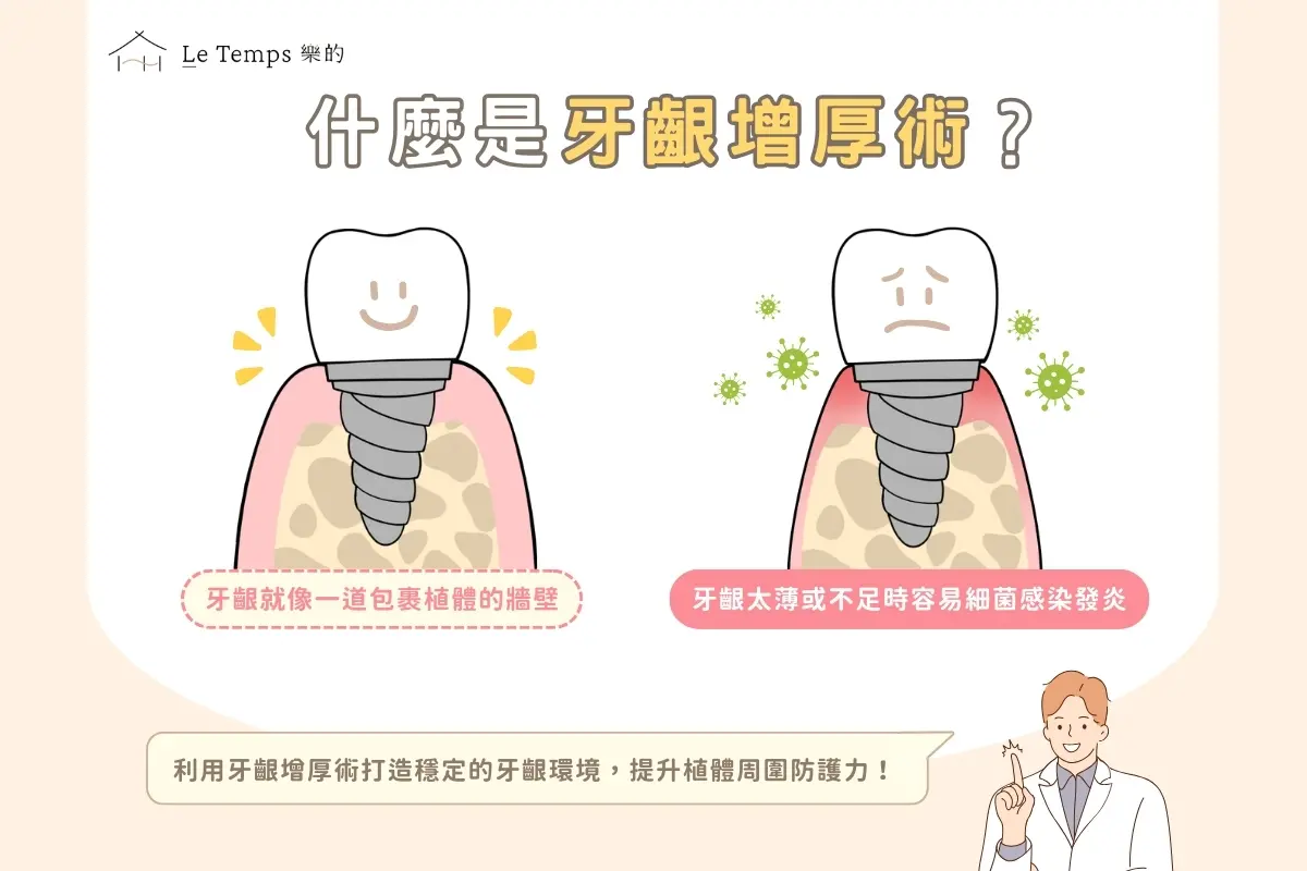 治療項目 牙齦增厚術（植牙補肉）1