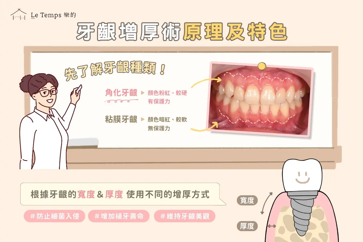 治療項目 牙齦增厚術（植牙補肉）2