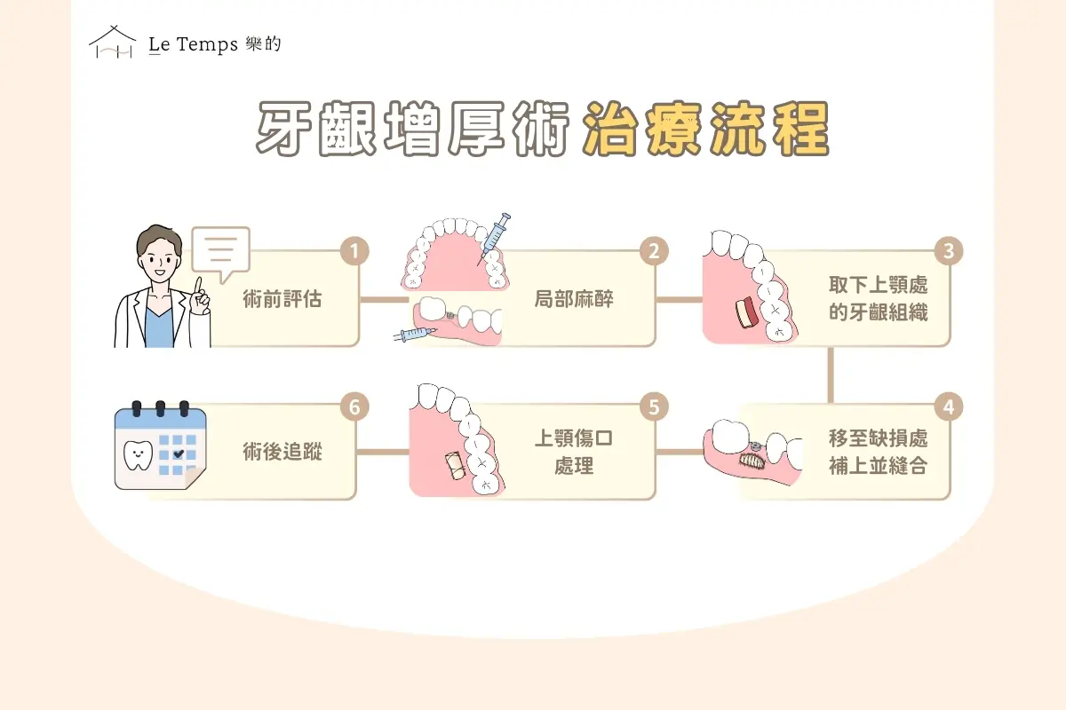 治療項目 牙齦增厚術（植牙補肉）3