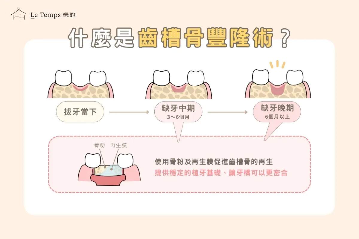 治療項目 齒槽骨豐隆術1