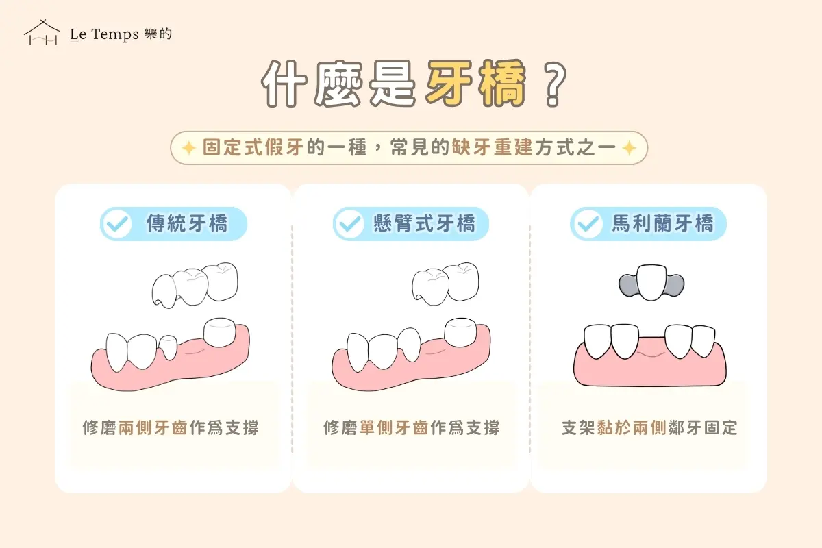 治療項目 牙橋1