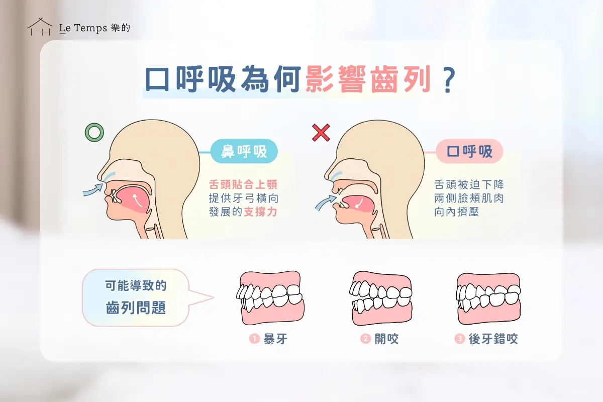 口呼吸專欄3