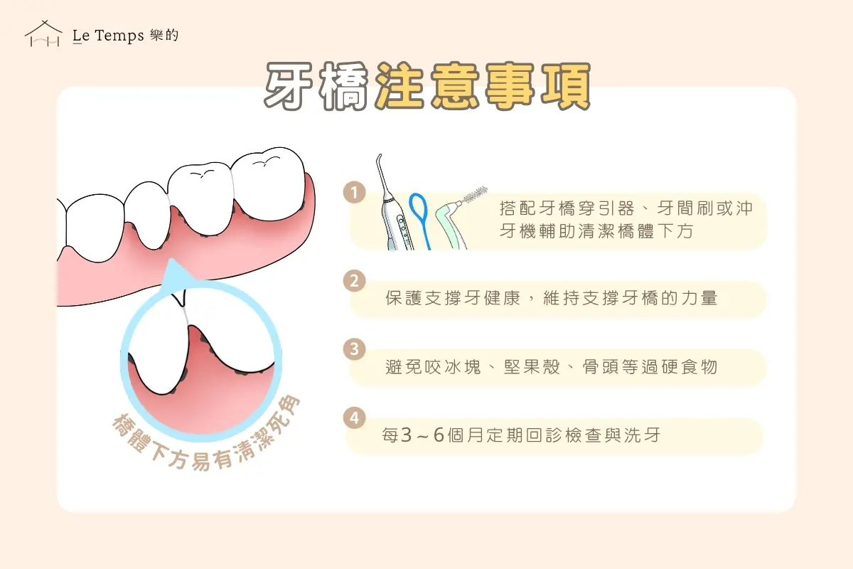 治療項目 牙橋5