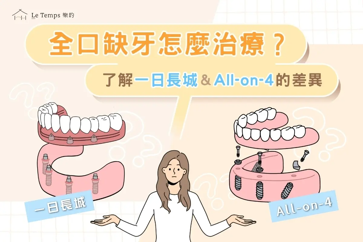 全口重建：一日長城與All-on-4
