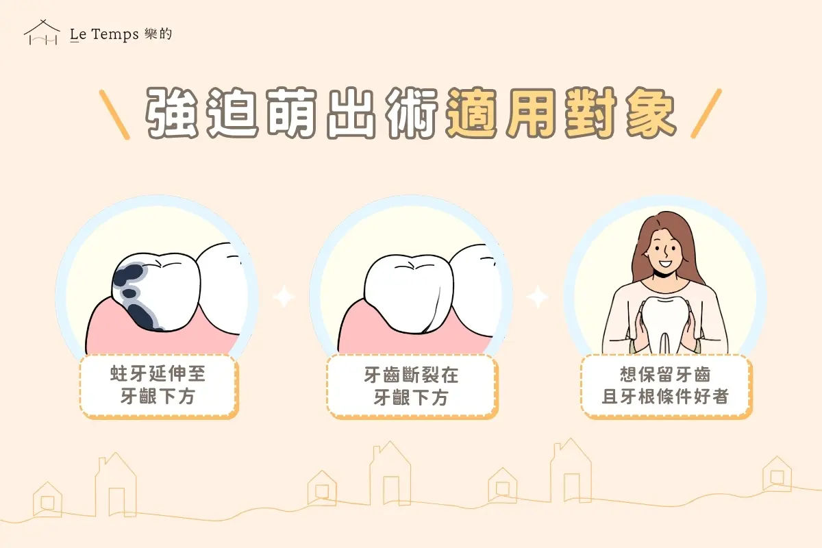 強迫萌出術適用對象