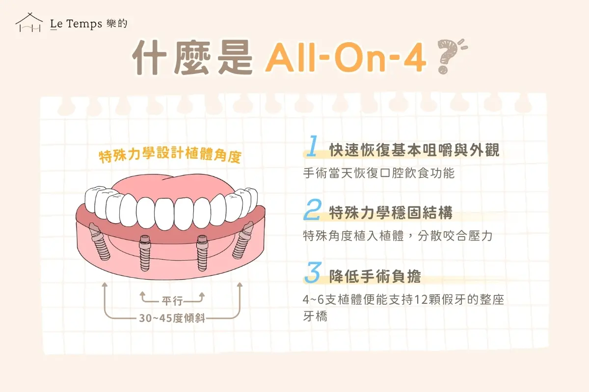 All On 4介紹
