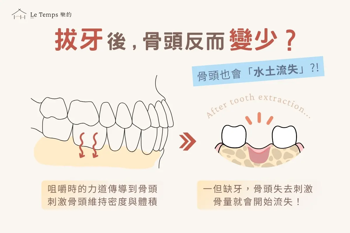 骨頭不夠，還能植牙嗎？術前一定要懂的骨質評估完整說明2