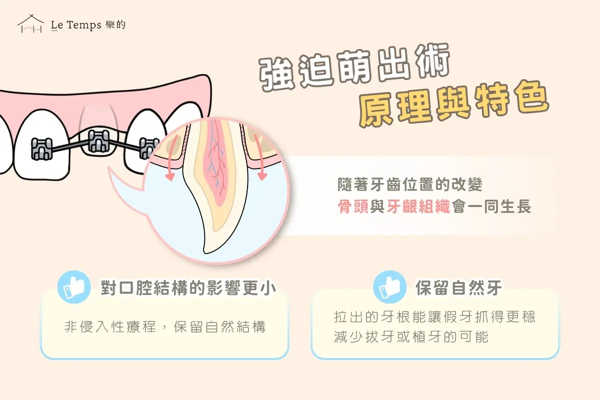 強迫萌出術原理與特色