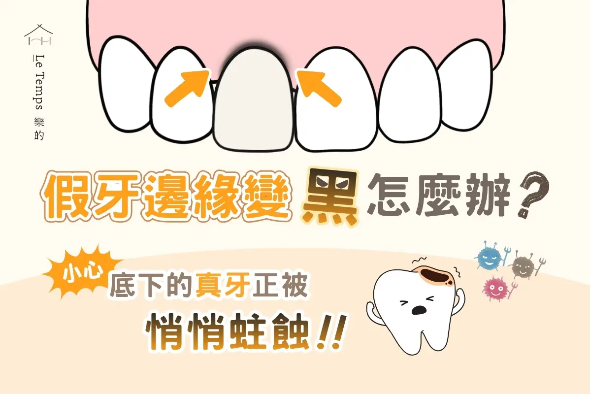 假牙邊緣變黑怎麼辦？小心不是染色，而是底下的真牙正在悄悄蛀蝕