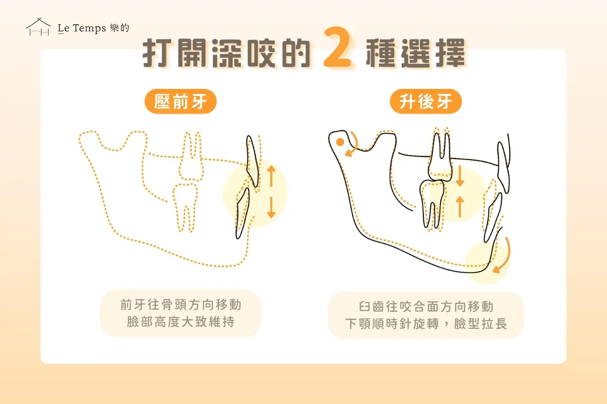 打開深咬的2種選擇