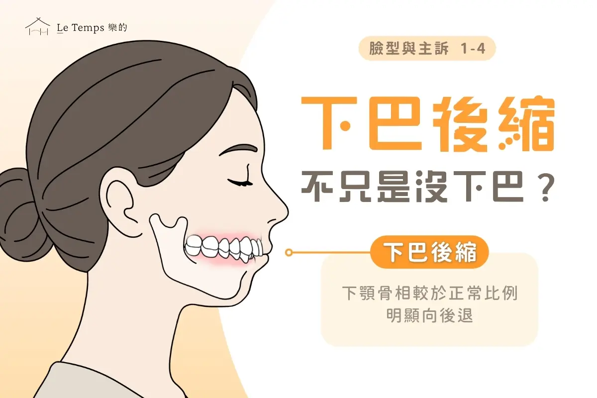 1 4下巴後縮不只是沒下巴？從側臉線條到呼吸道的完整解析