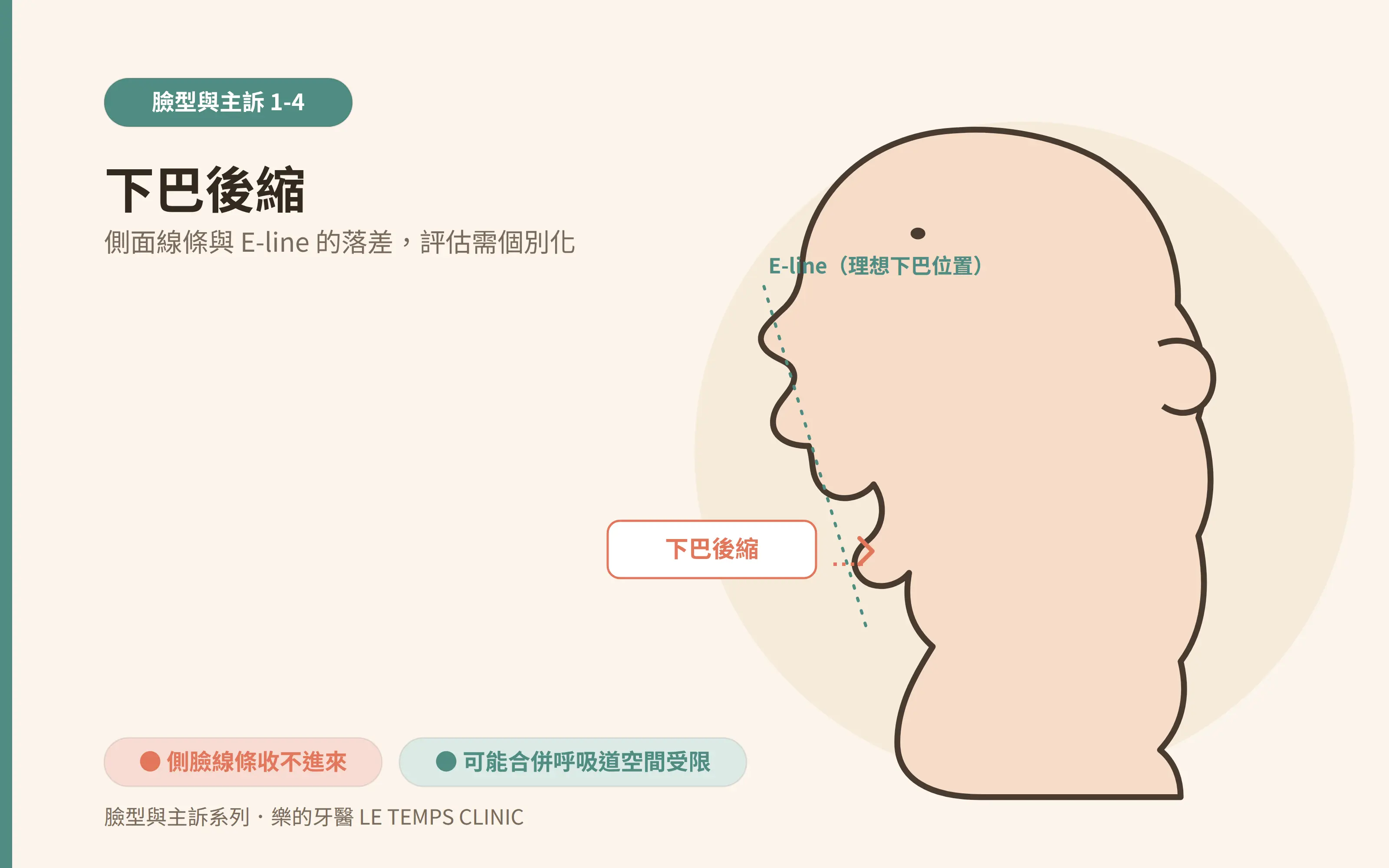 Ortho 1 4 Retruded Chin